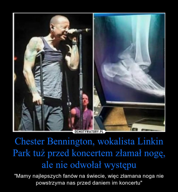 Chester Bennington, wokalista Linkin Park tuż przed koncertem złamał nogę, ale nie odwołał występu – "Mamy najlepszych fanów na świecie, więc złamana noga nie powstrzyma nas przed daniem im koncertu" 