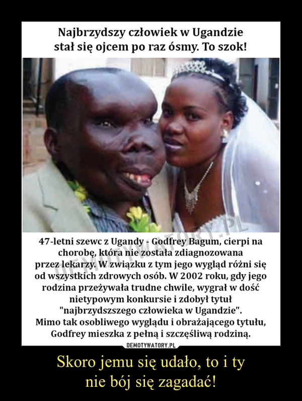 Skoro jemu się udało, to i tynie bój się zagadać! –  Najbrzydszy człowiek w Ugandziestał się ojcem po raz ósmy. To szok!47-letni szewc z Ugandy - Godfrey Bagum, cierpi nachorobę, która nie została zdiagnozowanaprzez lekarzy. W związku z tym jego wygląd różni sięod wszystkich zdrowych osób. W 2002 roku, gdy jego rodzina przeżywała trudne chwile, wygrał w dośćnietypowym konkursie i zdobył tytuł"najbrzydszszego człowieka w Ugandzie".Mimo tak osobliwego wyglądu i obrażającego tytułu, Godfrey mieszka z pełną i szczęśliwą rodziną.