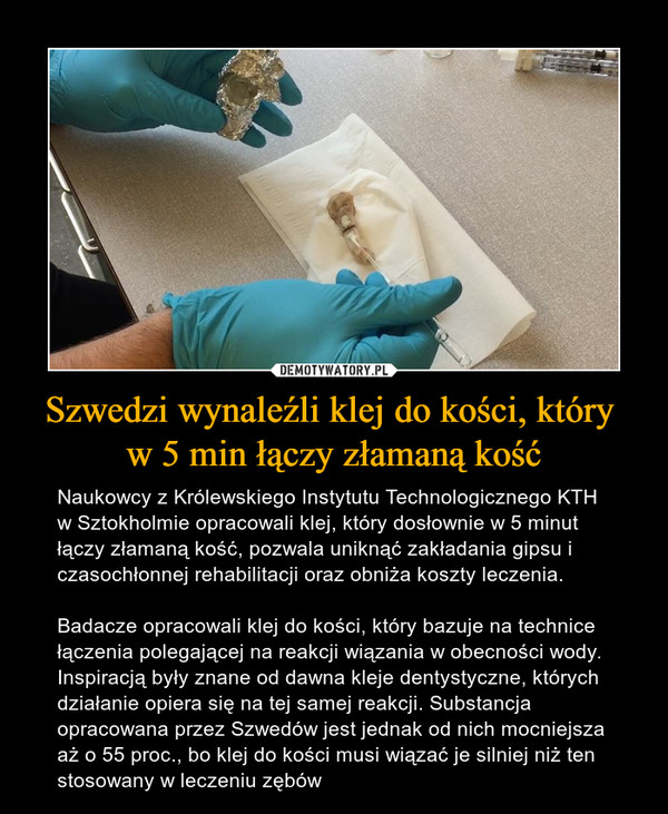 Szwedzi wynaleźli klej do kości, który 
w 5 min łączy złamaną kość
