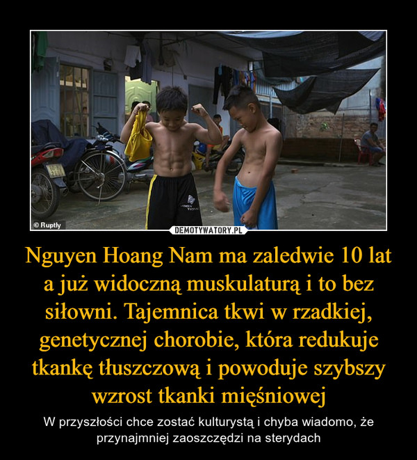 Nguyen Hoang Nam ma zaledwie 10 lat a już widoczną muskulaturą i to bez siłowni. Tajemnica tkwi w rzadkiej, genetycznej chorobie, która redukuje tkankę tłuszczową i powoduje szybszy wzrost tkanki mięśniowej