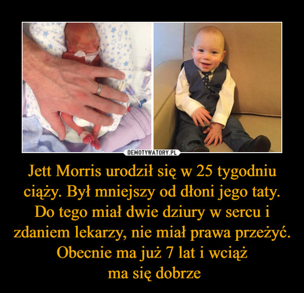 Jett Morris urodził się w 25 tygodniu ciąży. Był mniejszy od dłoni jego taty. Do tego miał dwie dziury w sercu i zdaniem lekarzy, nie miał prawa przeżyć. Obecnie ma już 7 lat i wciąż ma się dobrze –  