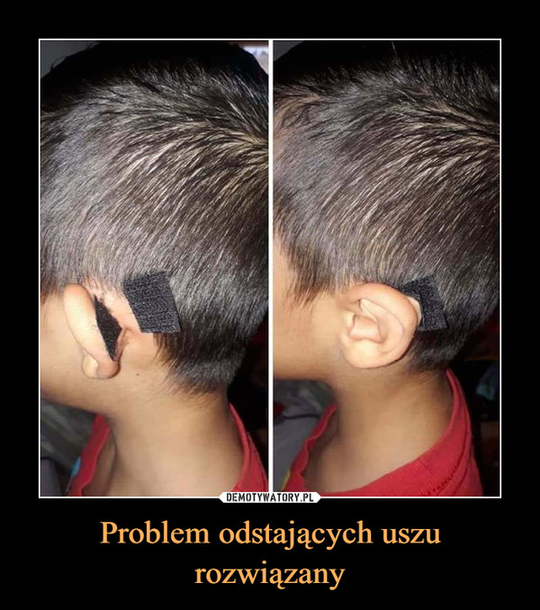 Problem odstających uszu rozwiązany –  